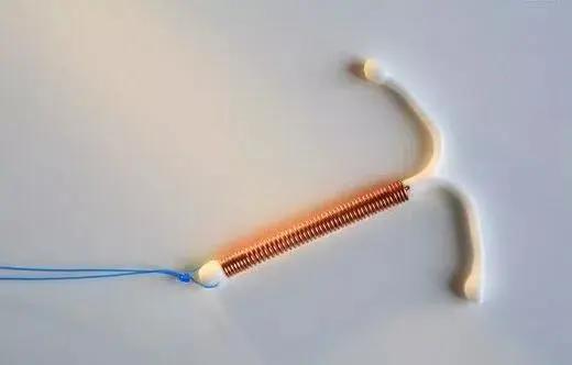 30年前上的避孕环,20年前上的避孕环