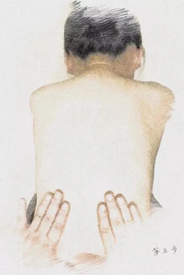 脊柱侧弯专科门诊,脊柱侧弯挂脊柱外科