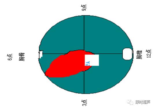 胎儿心脏三种血管关系模式图,25周的胎儿心脏弓切面多少正常