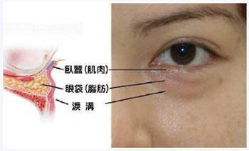 眼部有细纹用眼膜有用吗,眼部细纹眼膜有用吗