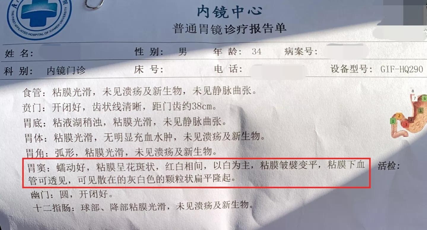 萎缩性胃炎无法逆转？刘慧敏主任：这两点很重要