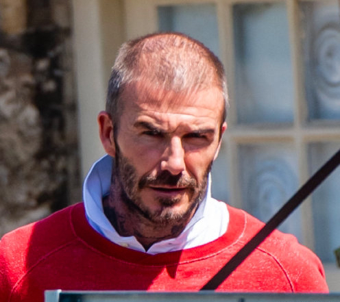 小贝热搜,小贝脱发