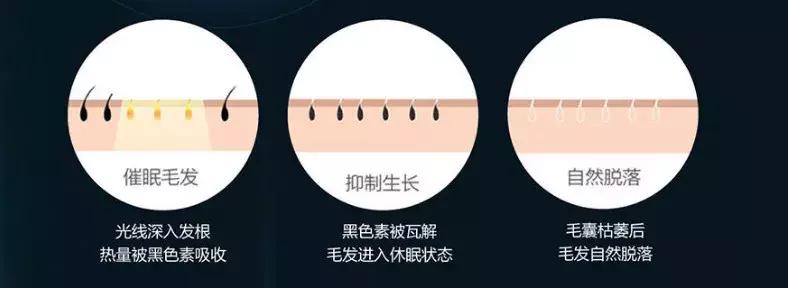 想要脱毛用什么最好,opt冰点脱毛仪器祛斑