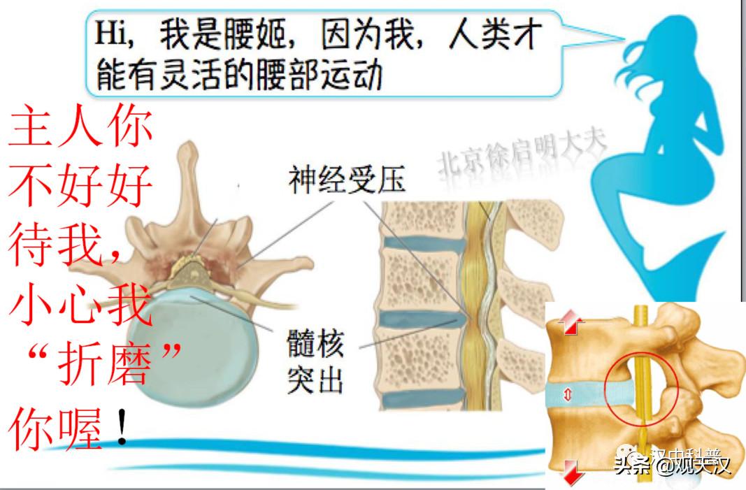 「专家讲科普」*建华陈**:守护好自己的脊梁——腰椎健康保健及防治知识