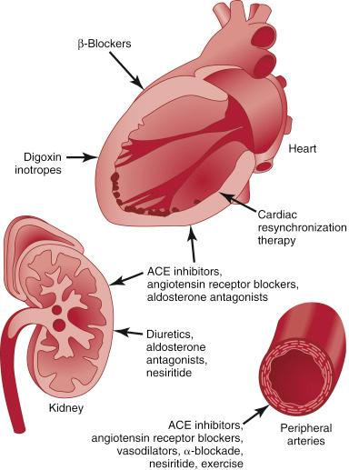 心衰强心利尿扩血管的药物,心衰使用血管扩张剂原理