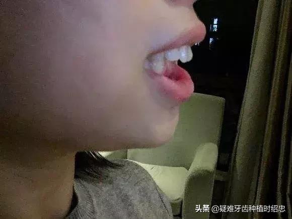 你的牙齿是否符合以上标准呢,你的牙齿够整齐吗