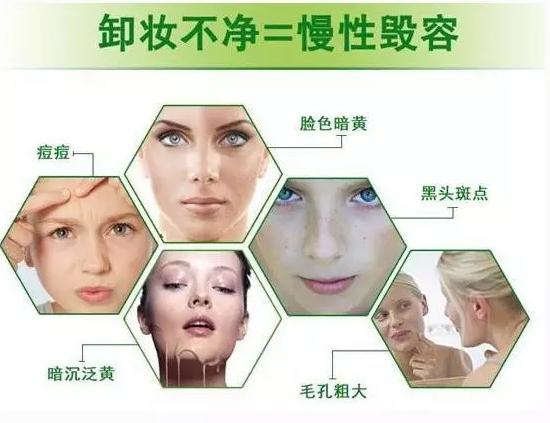 卸妆怎么才能卸干净呢,卸妆没卸干净怎么补救
