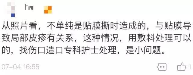 水泡破了如何处理,手掌水泡破了怎么处理