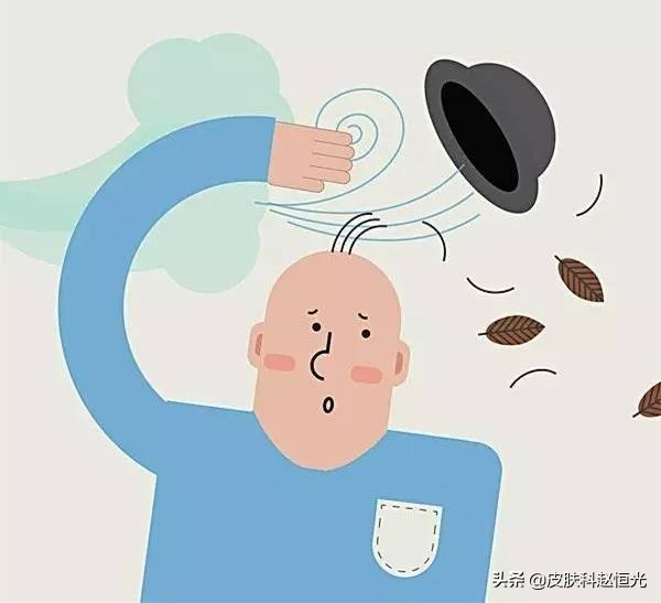 米诺地尔停用脱得更多吗,米诺地尔依赖性和副作用