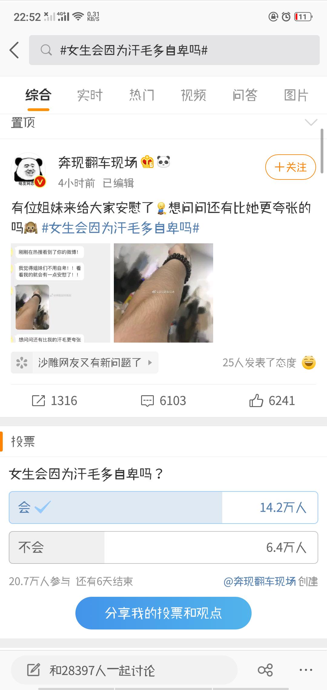 女生汗毛又多又长自卑怎么办,医生教你怎么去除体毛