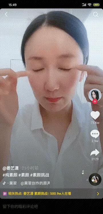 娄艺潇填充脂肪前后对比,娄艺潇填充前后对比