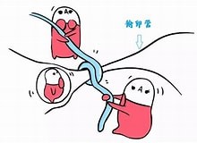 输卵管不孕是怎么回事？一篇文章搞懂输卵管不孕