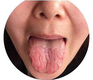 中医看舌头知病情图片,看舌头知病情图解大全