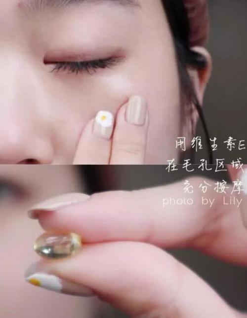 鼻子上的黑头怎么去得掉,鼻子上的黑头很痛怎么办