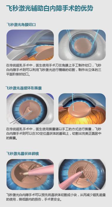 让双目失明的人重新复明的医生,让盲人再次重现光明的科技