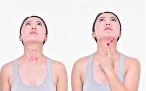 流口水针灸扎几个止涎穴,董氏奇穴治成人流口水