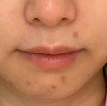 科颜氏抗初老精华露元气弹,科颜氏小白瓶跟元气弹