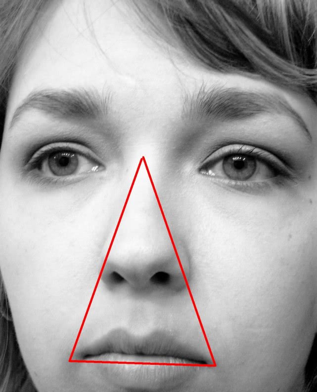 大惊失色!挤完痘痘这样做，很有可能会导致失明，甚至踏上黄泉路