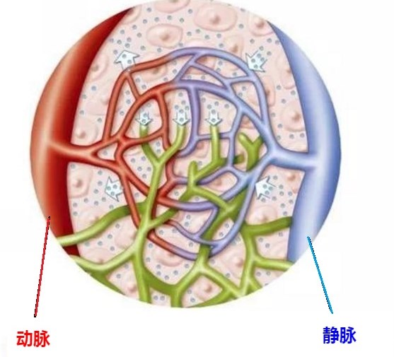 流产导致的动静脉瘘能治愈吗,流产不干净形成血管瘘