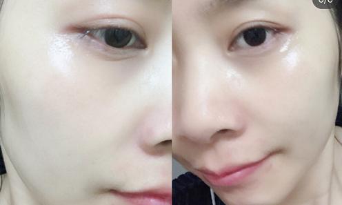 补水保湿精华液第一名正品,补水原液推荐