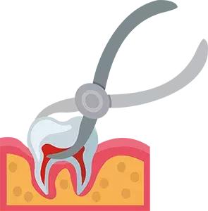 智齿疼是拔掉好还是治疗好,智齿疼是拔掉还是治疗