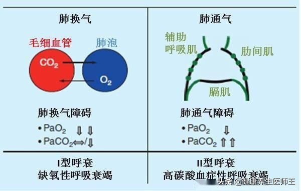 呼吸衰竭临终痛苦吗,i型呼吸衰竭的意思