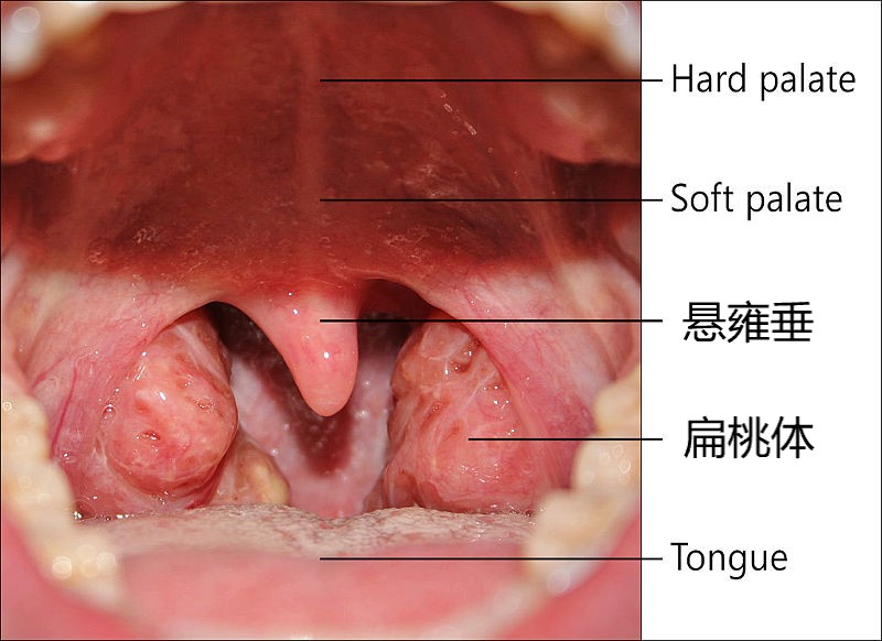 睡觉打呼噜憋住了,打呼噜把自己憋醒对身体有伤害吗
