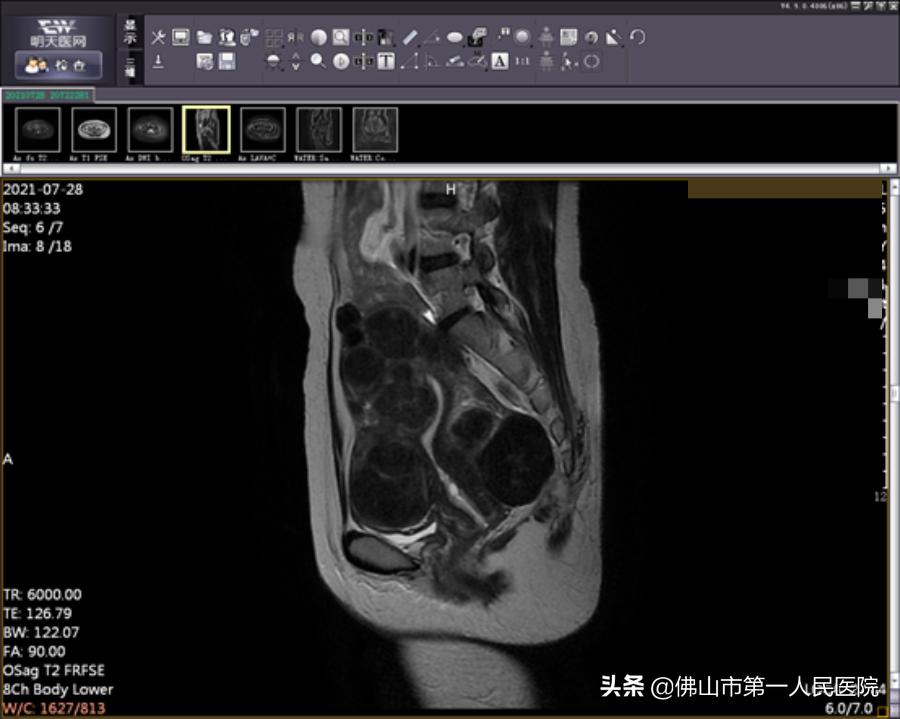 这把“刀”能隔山打“牛”,呵护子宫,带来好“孕”