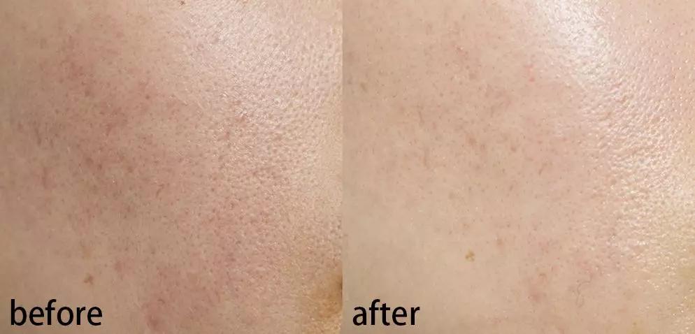 真人改造|不靠医美，一天实现“换皮”