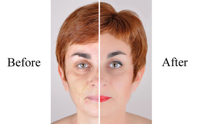 50岁头发稀少增发方法,16岁头发稀少如何增发