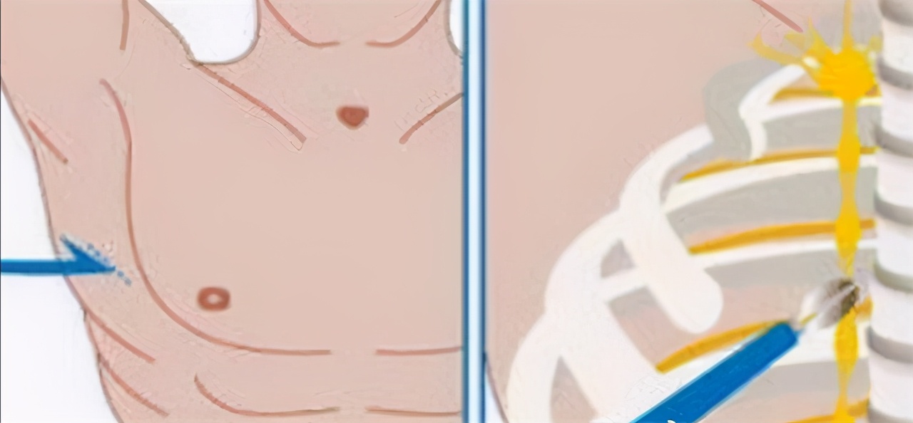 汗手症怎么治疗最有效,治疗手汗症保守的方法