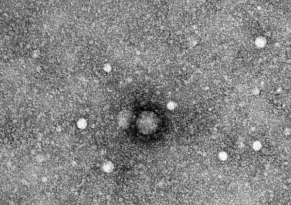 楼上感染了新冠楼下怎么防护,楼上楼下防止病毒方法