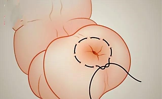 猪身上发红发紫又脱肛怎么办,猪脱肛最佳的治愈方法