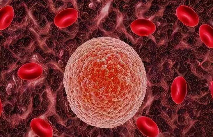 胆红素和间接胆红素偏高说明什么,胆红素升高主要原因咨询专家