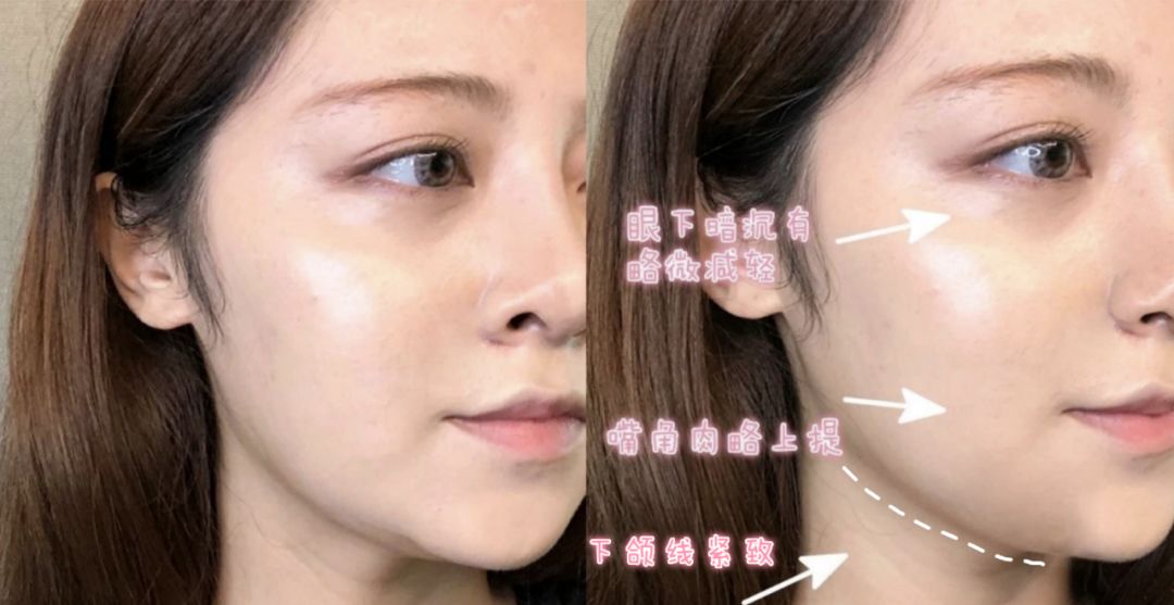 瘦脸方法17天,瘦脸方法学生适用一天瘦十斤