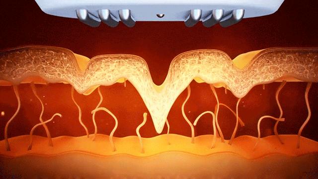 收缩毛孔粗大的方法测评,拯救粗大毛孔的救星来啦