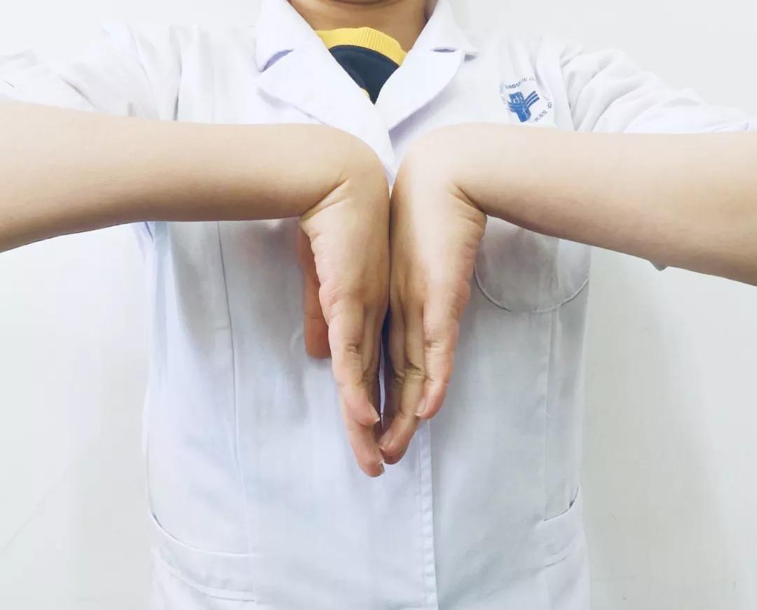 女子出现手麻，拖延1年后就医，手掌这地方已“瘪”掉！​年轻人易中招