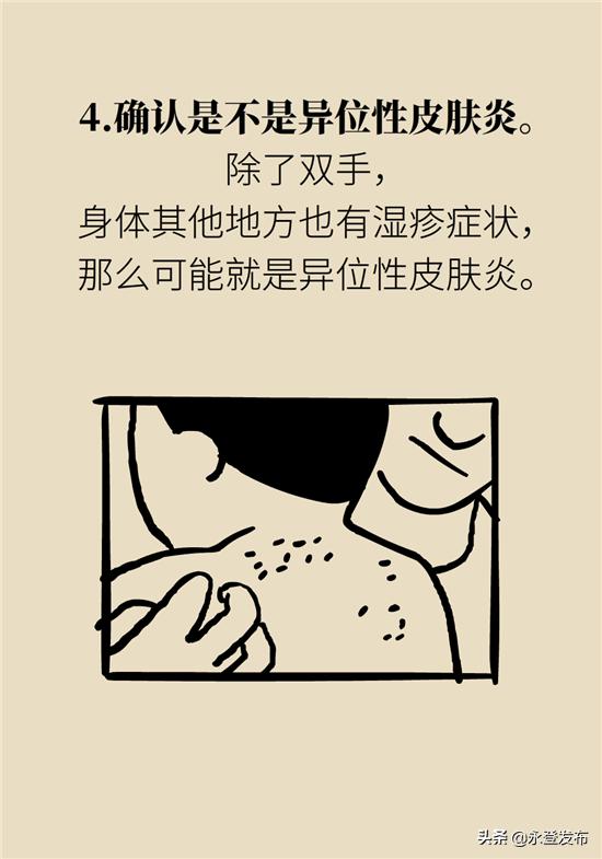 湿疹膏有哪些治疗效果好的,湿疹膏可以治愈吗