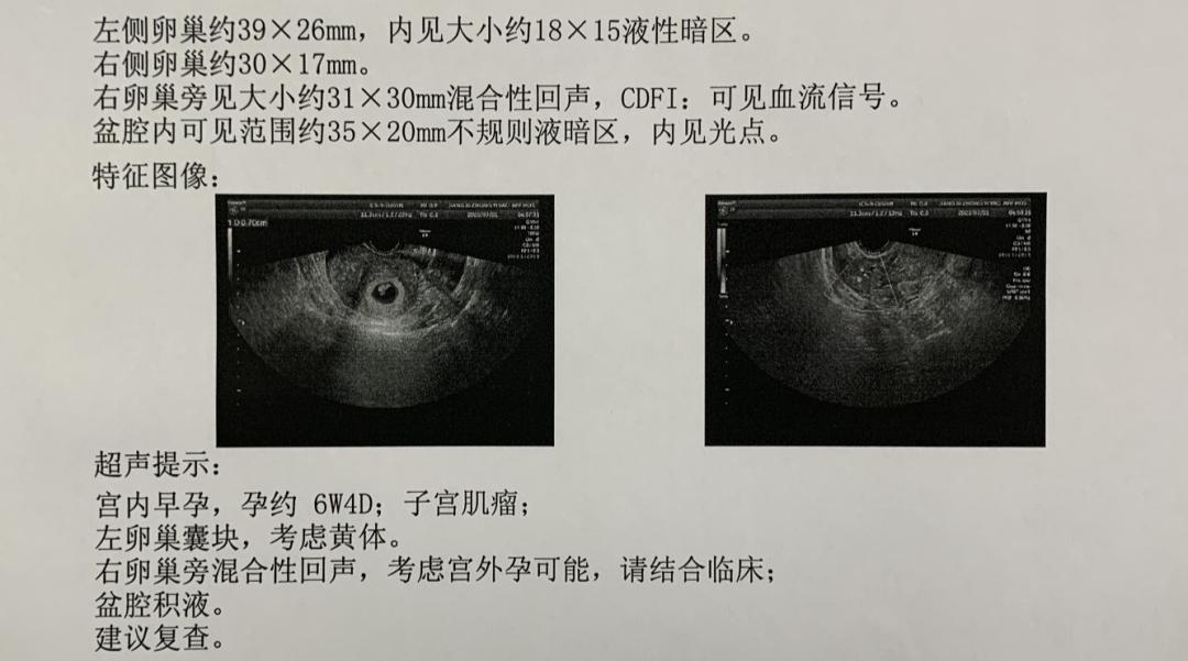 危险期内怀孕的几率有多大,危险期外怀孕的几率
