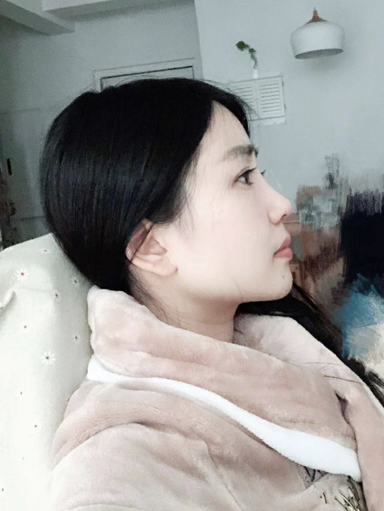 大小眼+歪鼻改善！精致感立显，仿若换头！