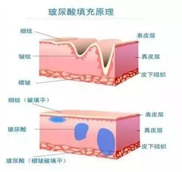 《美容针》简介,美容针知识大全