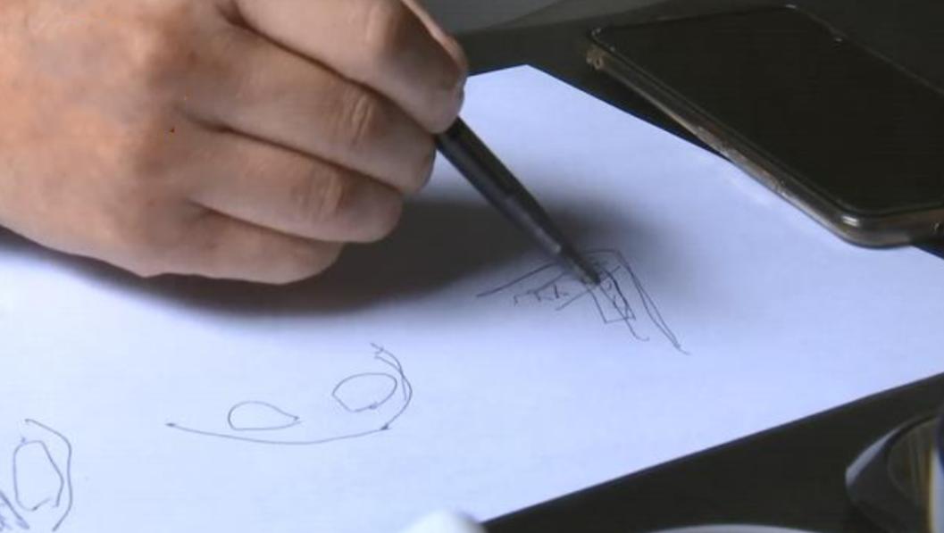 打个喷嚏鼻子假体掉出来了,打了个喷嚏堵在鼻子里了