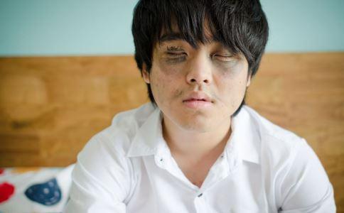 熬夜容易有熊猫眼如何消除黑眼圈,熊猫眼黑眼圈治疗偏方