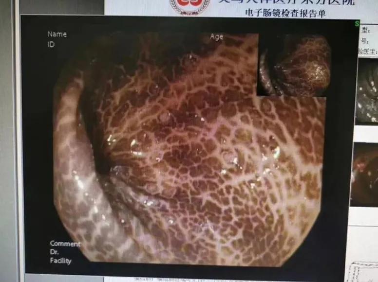 酵素真的能调理肠道吗,酵素治百病是真的吗