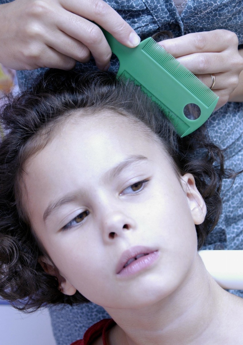 女儿头上长虱子妈妈给剃光了,女童冬天头上有虱子怎么办