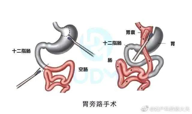 网红泡泡龙不幸猝死,网红泡泡龙于海龙去世