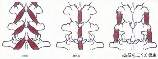 国外压缩性骨折治疗方案,压缩性骨折自愈技巧图片