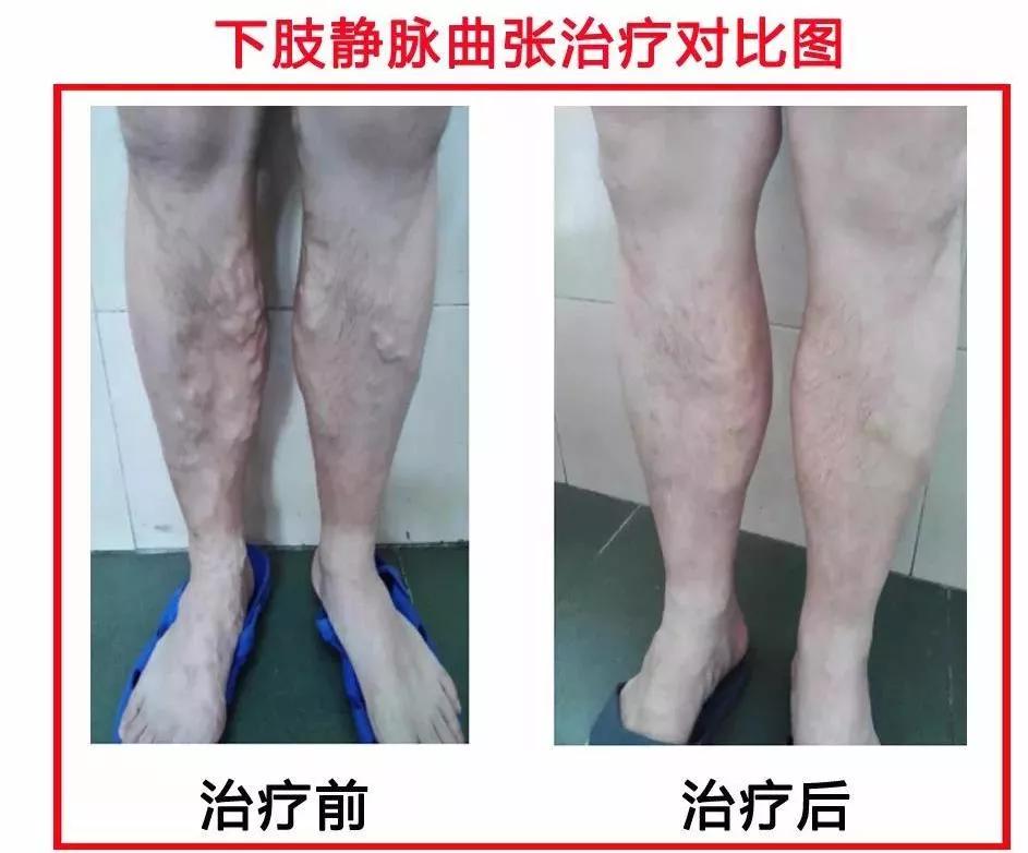 中西医结合医院手术,中西医结合双剑合璧