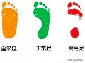 足底筋膜炎可以快走吗,足底筋膜炎快走