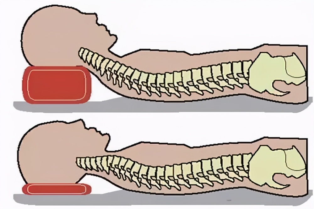 颈椎病人枕多高枕头为宜,颈椎病枕黄豆枕头怎么做
